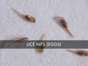 lice eggs