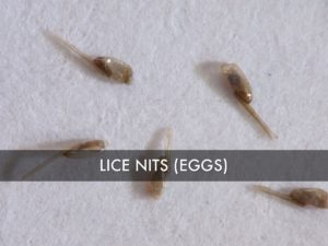 What Does Lice Look Like? Pictures of Nits, Eggs & Lice