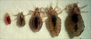 Three Stages Of Growth For Lice Greater Vancouver Lice Clinic